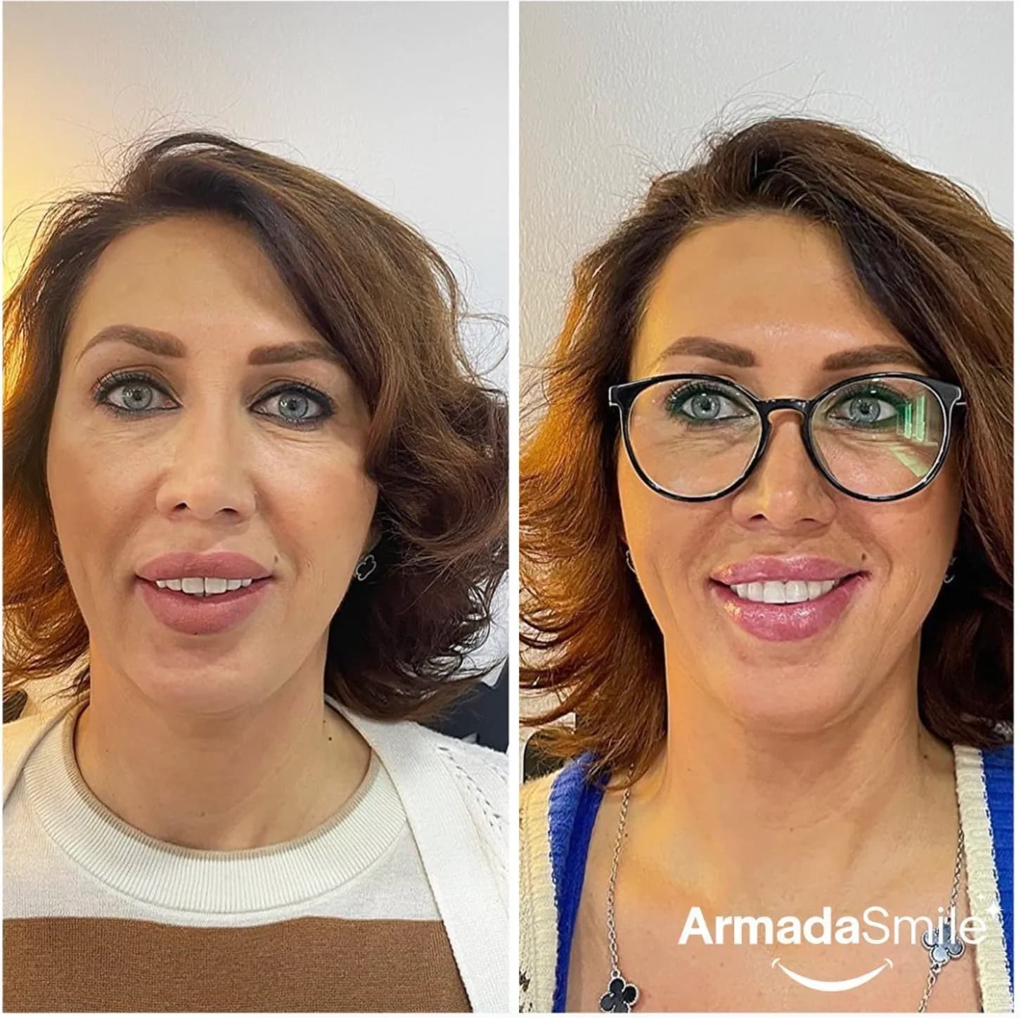 Before & after dental transformation 2