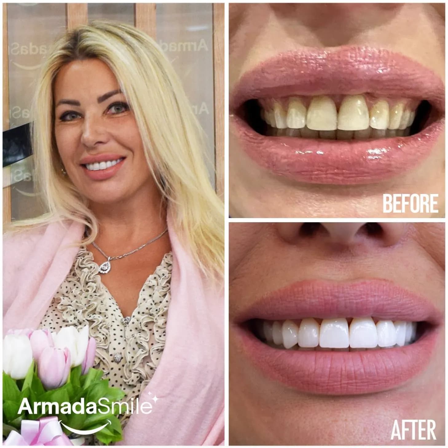 Before & after dental transformation 3