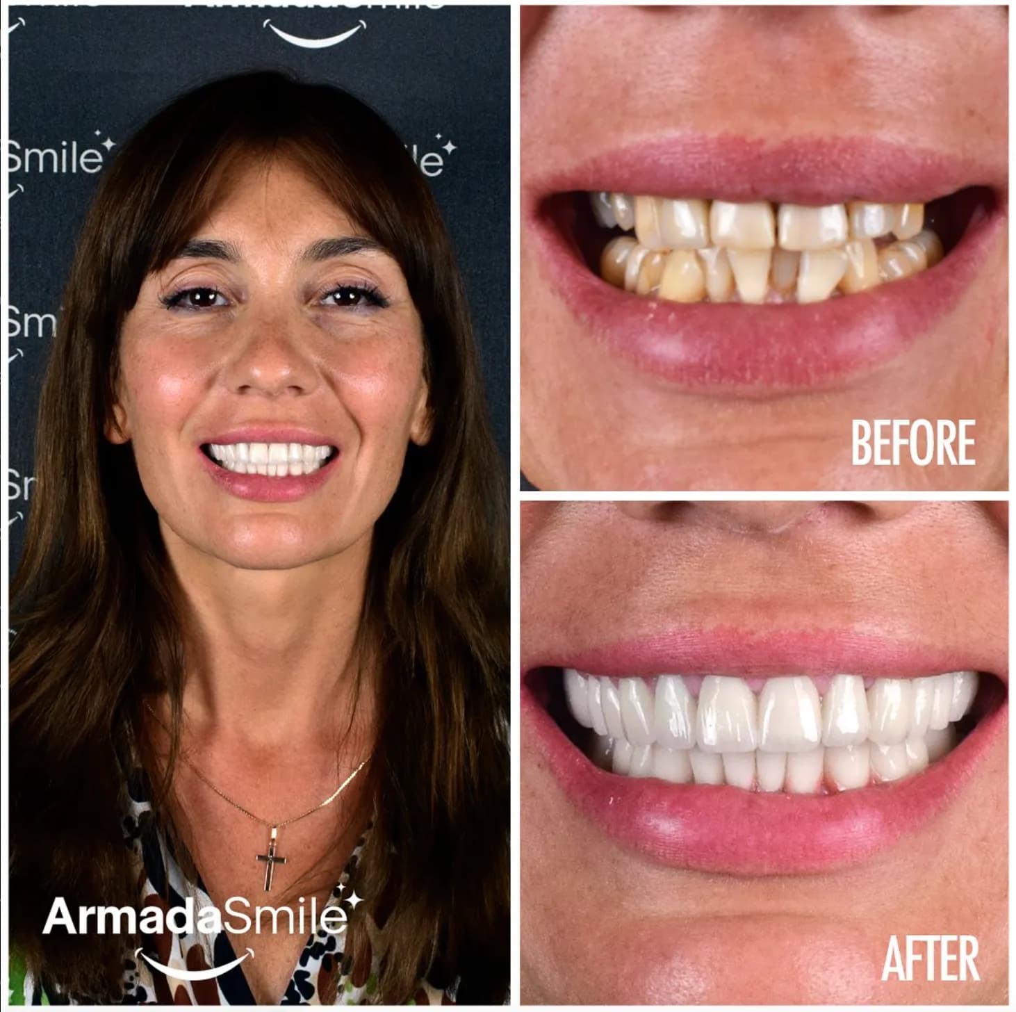 Real transformations from real patients.