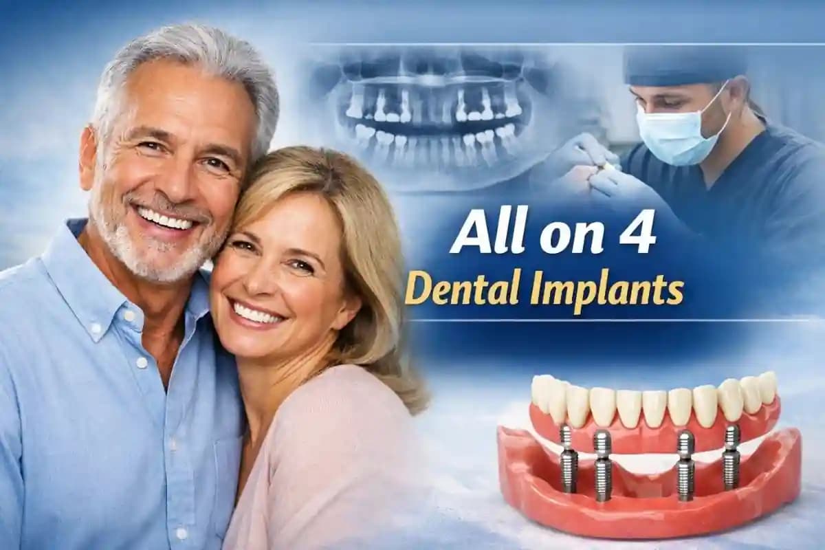 All-on-4 Dental Implants